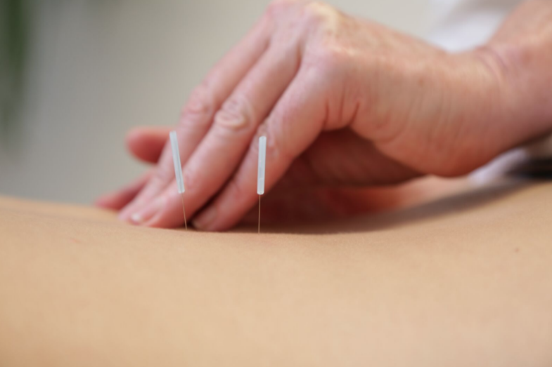 Acupuncture for morning sickness, nausea and pregnancy