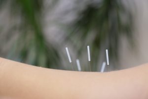Improving male fertility with acupuncture at London clinic